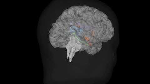 diencephalon extraction FreeSurfer+Matlab