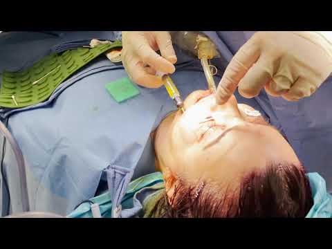 Behind the scenes of a Facial Rejuvenation Surgery with Dr Paul Nassif