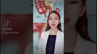 Download Lagu Ano nga ba ang APPENDICITIS? 🤔 | KRIZZLE LUNA MP3