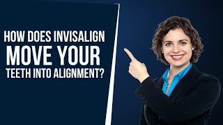 How Does Invisalign Move Your Teeth into Alignment? | Dental House MI