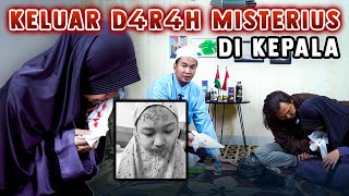 KELUAR D4R4H MISTERIUS DI KEPALA