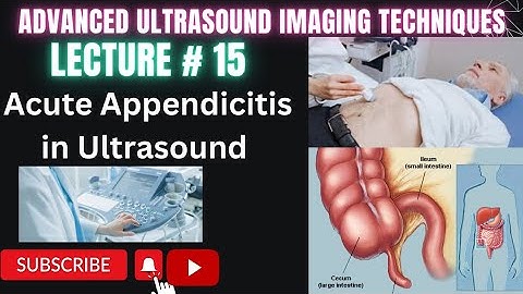 How to do appendix ultrasound Part 3 Acute Appendicitis #ultrasound #technology #medical