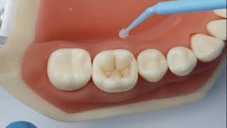 Class 2 Composite