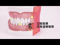 3M 三效漱口水隨身瓶(薄荷口味)120ml product youtube thumbnail