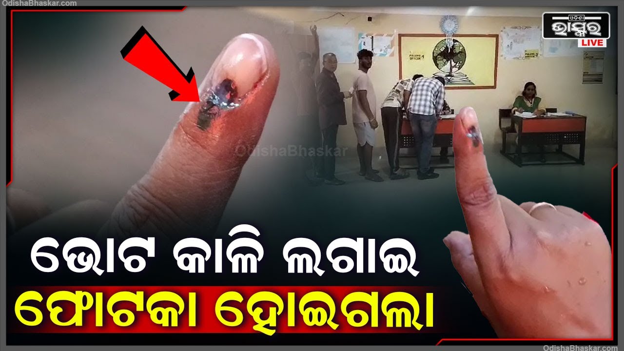ଭୋଟ ଦେବା ପରେ କାଳି ଲଗାଇ ଆଙ୍ଗୁଠି ଫୋଟକା ହୋଇଗଲା, ଚମଡ଼ା ଉତୁରିଗଲା ଆଙ୍ଗୁଠିରୁ
