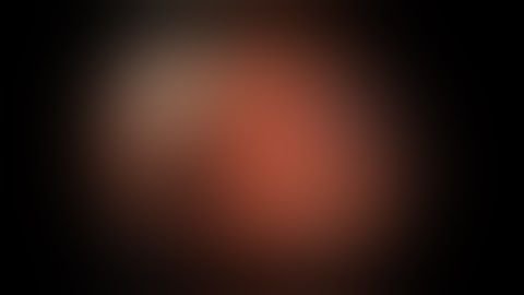 Endoluminal Stomach-Sparing Resection of Gastric Gists