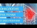 Узнать всё о РАКЕ ПОЧКИ! Симптомы рака почки, диагностика и лечение | Добрый Прогноз