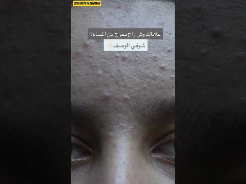 برائيكم وش راح يخرج من المسام اقرئي الوصف 