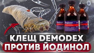 видео: Клещ DEMODEX против Йодинол | Угревая Железница Demodex картинка: Клещ DEMODEX против Йодинол | Угревая Железница Demodex