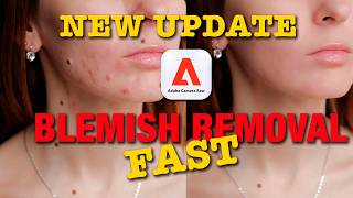 New ACR Update: Blemish Removal Adobe Camera Raw