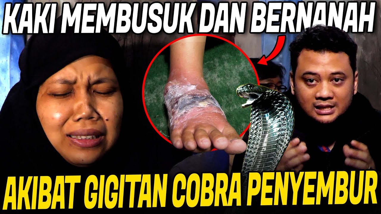 KAKI TERANCAM DIAMPUT*SI !! NOLONG KORBAN GIGITAN ULAR COBRA PENYEMBUR
