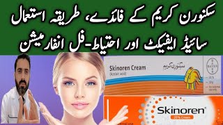 Skinoren Cream Uses and Side Effects | Skinoren Cream How To Use | Azelaic Acid Cream Review