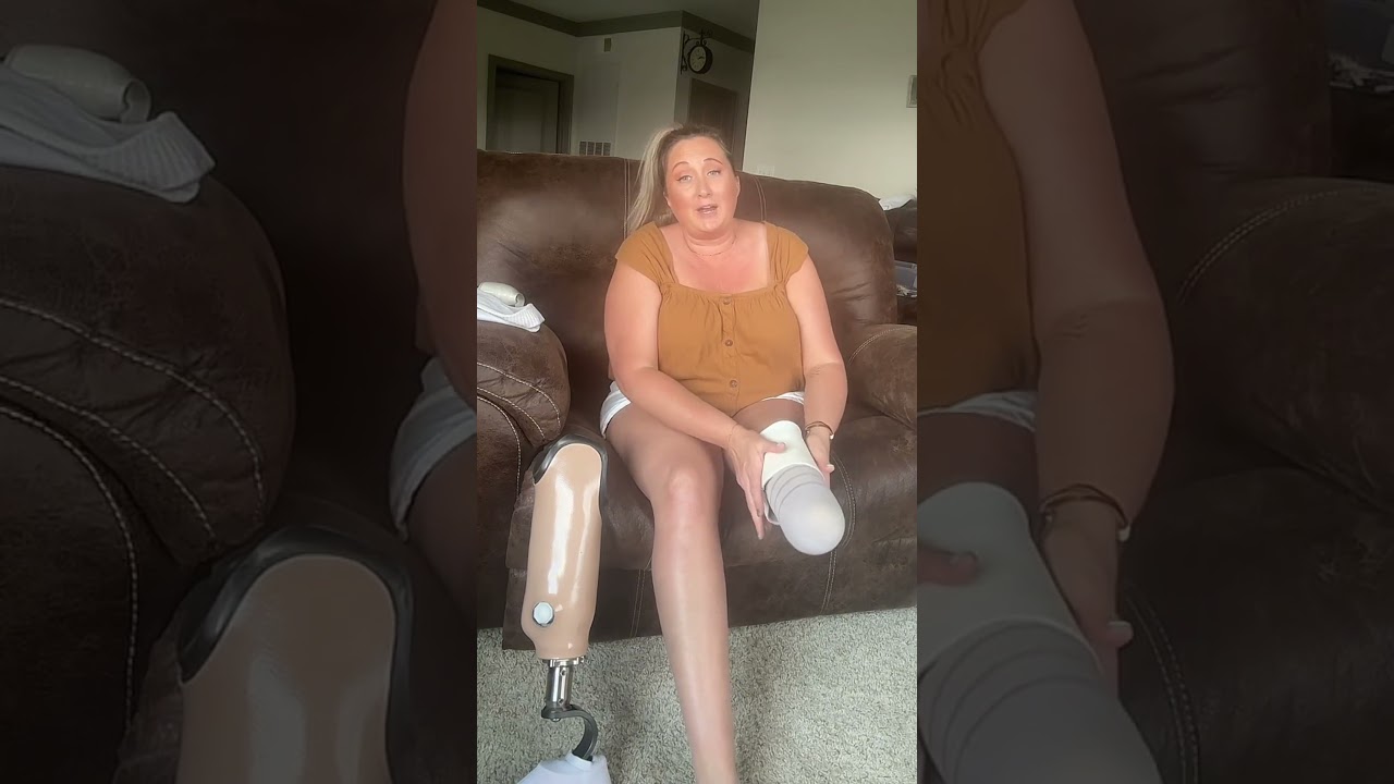 #electiveamputationdecisionmaking