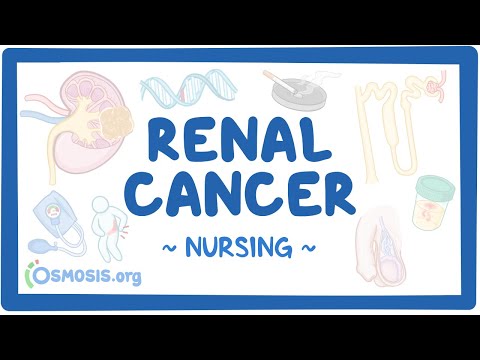 Video: Teno are cancer?