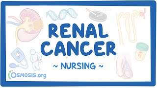 Renal Cancer: Clinical Nursing Care