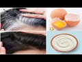 My 65 Years Mother Applied Natural Dye Once A Week &amp; Covered White Hair Permanently | White Hair Dye