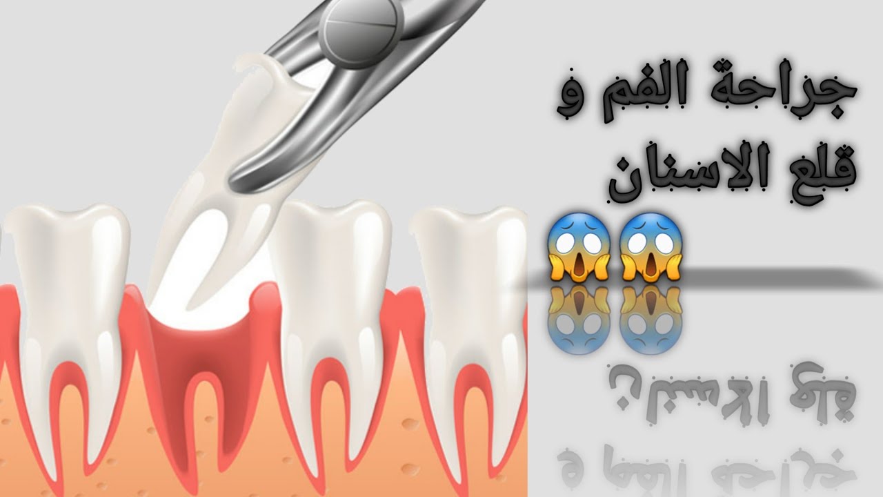 Oral & Maxillofacial Surgery جراحة الفم