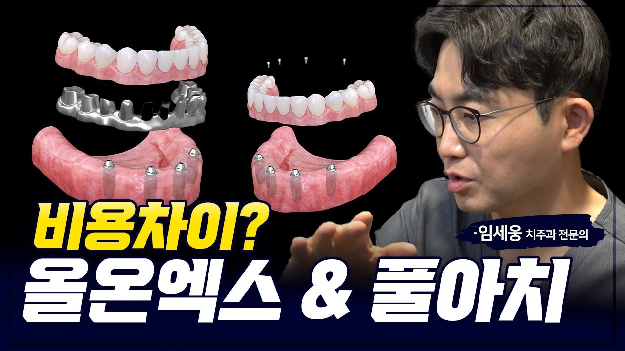 올온엑스? 풀아치? 제대로 알려드릴게요 #올온엑스 #풀아치 #비용