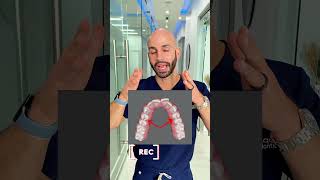Invisalign to Fix a Narrow Smile for Our Patient (showing our actual 5-month progress results)