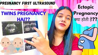 Early Pregnancy Scan 6 Week First Ultrasound In Pregnancy Ectopic Pregnancy In Hindi