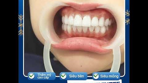 [CẬN CẢNH] DÁN SỨ CÔNG NGHỆ #MINISHLAMINATE