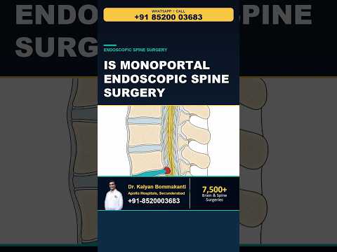 What Is Monoportal Endoscopic Spine Surgery? - Best Endoscopic Spine Surgeon in Hyderabad