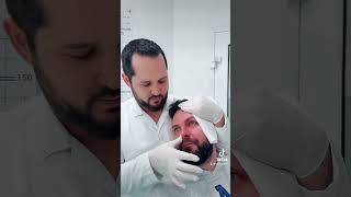 Treatment Nose