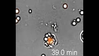 S1 Polymorphonuclear Cells with Conidia in Liquid Media ogv 180p vp9