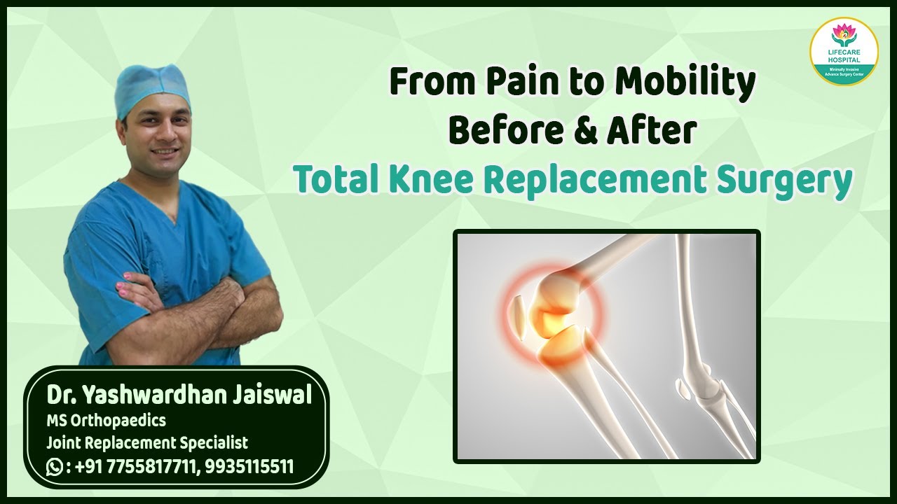 From Pain to Mobility | Total Knee Replacement Before & After - YouTube