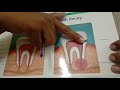 root canal treatment