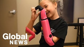 8-year-old Texan girl uses her bionic hand for first time