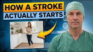 What a Stroke Looks Like the Day Before It Hits — Know This to Protect Yourself -