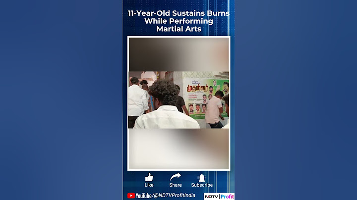 11-Year-Old Child Sustains Burns While Performing Martial Arts In Tamil Nadu #shorts