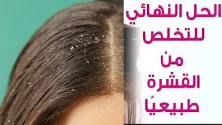 طرق طبيعيه لعلاج قشره الشعر وحده الرأس من اول مره ومضمونه وهتخلى شعرك زى الحرير