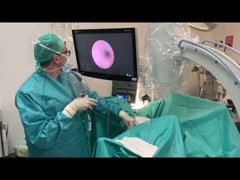 Video: ¿Qué significa uroscopia?