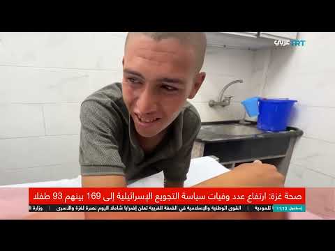 وفاة طفل فلسطيني بغزة بسبب سوء التغذية وتدهور الأوضاع