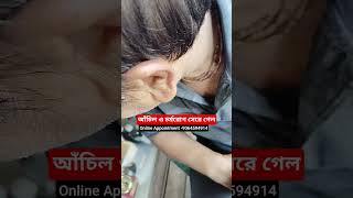 আঁচিল ও চর্মরোগ সেরে গেল,Warts &amp; Skin Disease Cured,All India medicine delivery available #drbd