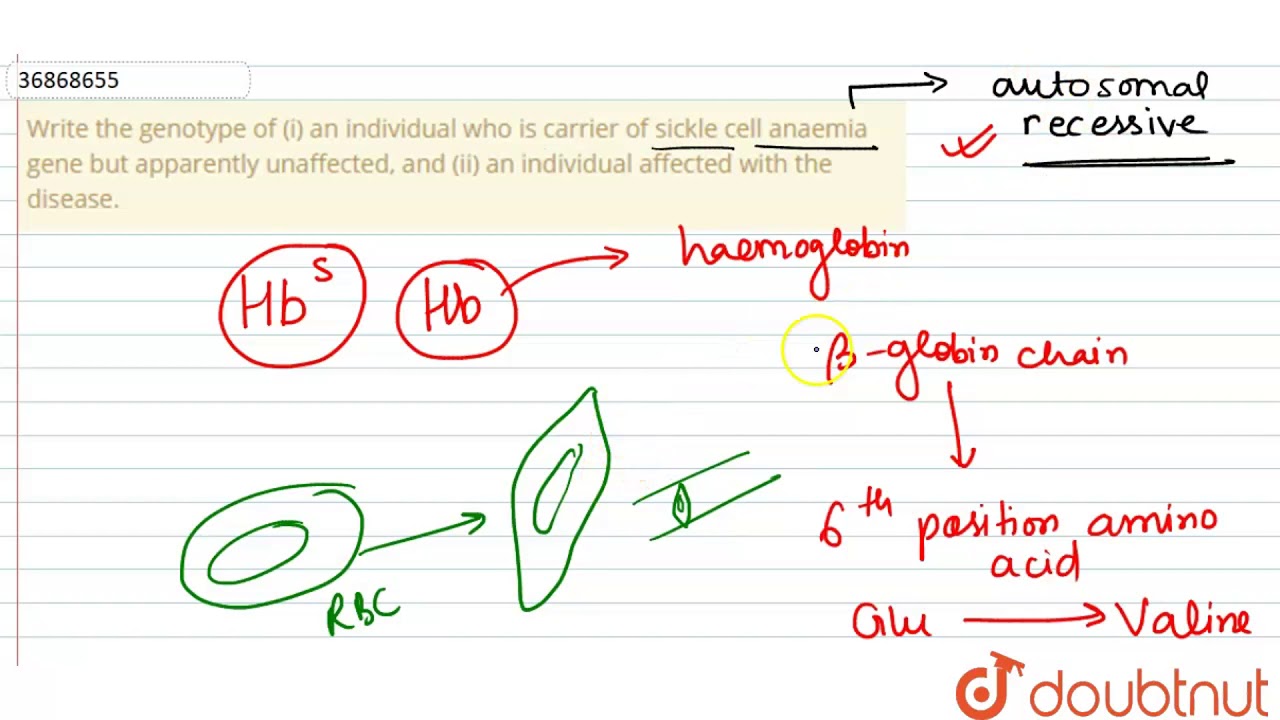 Write The Genotype Of I An Individual Who Is Carrier Of Sickle Cell Anaemia Gene But Apparently Youtube