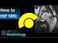 How to read Hip MRI