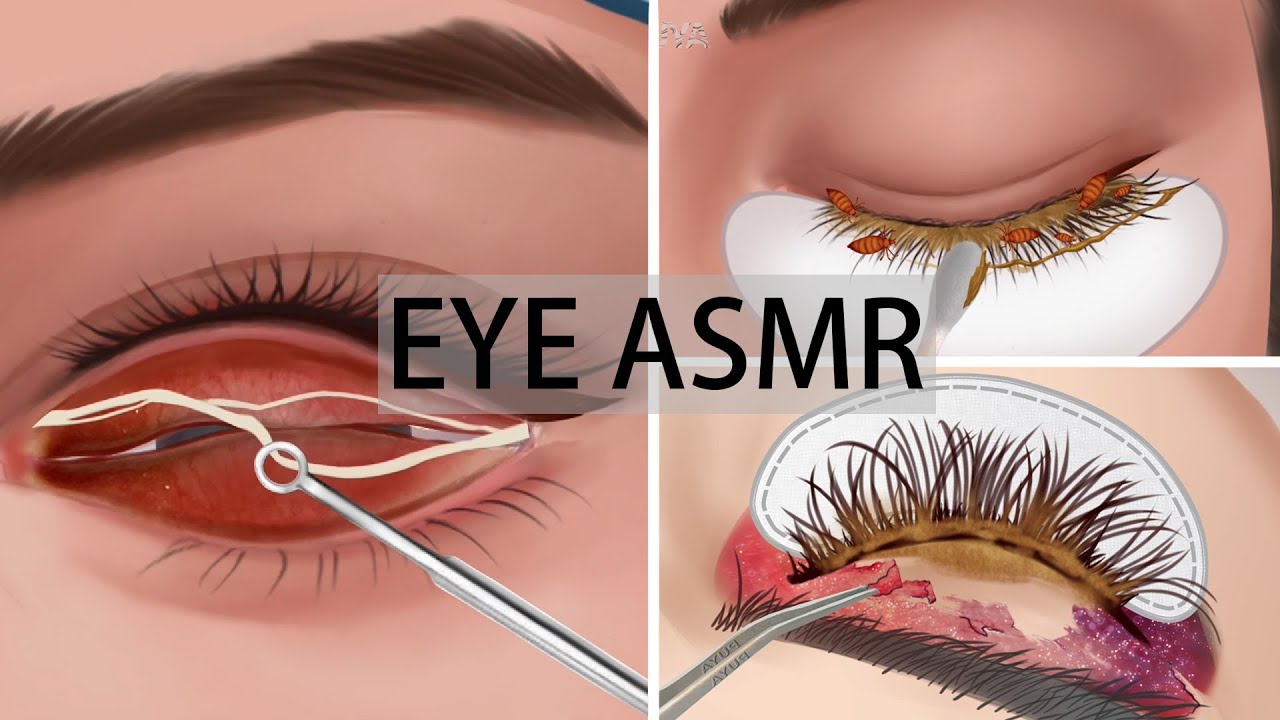 Eye ASMR lashes cleaningeye mucous removal animationremove eyelashes