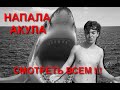 В БАЛТИЙСКОМ МОРЕ НАПАЛА АКУЛА!!! ШОК!!! 18+