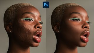 High-End Skin Retouching Beginner Photoshop Tutorial | Cleansing the face #photoshop