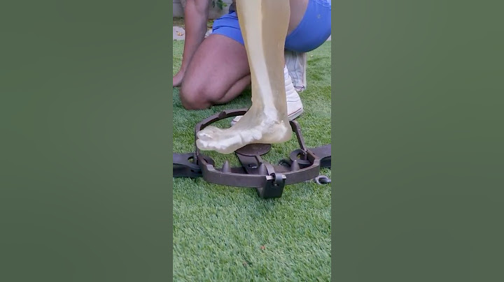 Bear Trap VS Leg