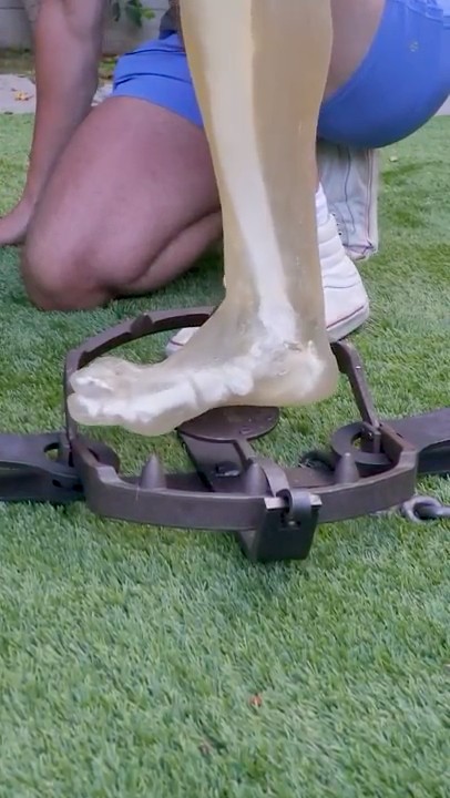Bear Trap VS Leg