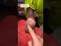 Get Rid Of Cracked Heels / Repair Cracked Heels Easily At Home #shorts #heels