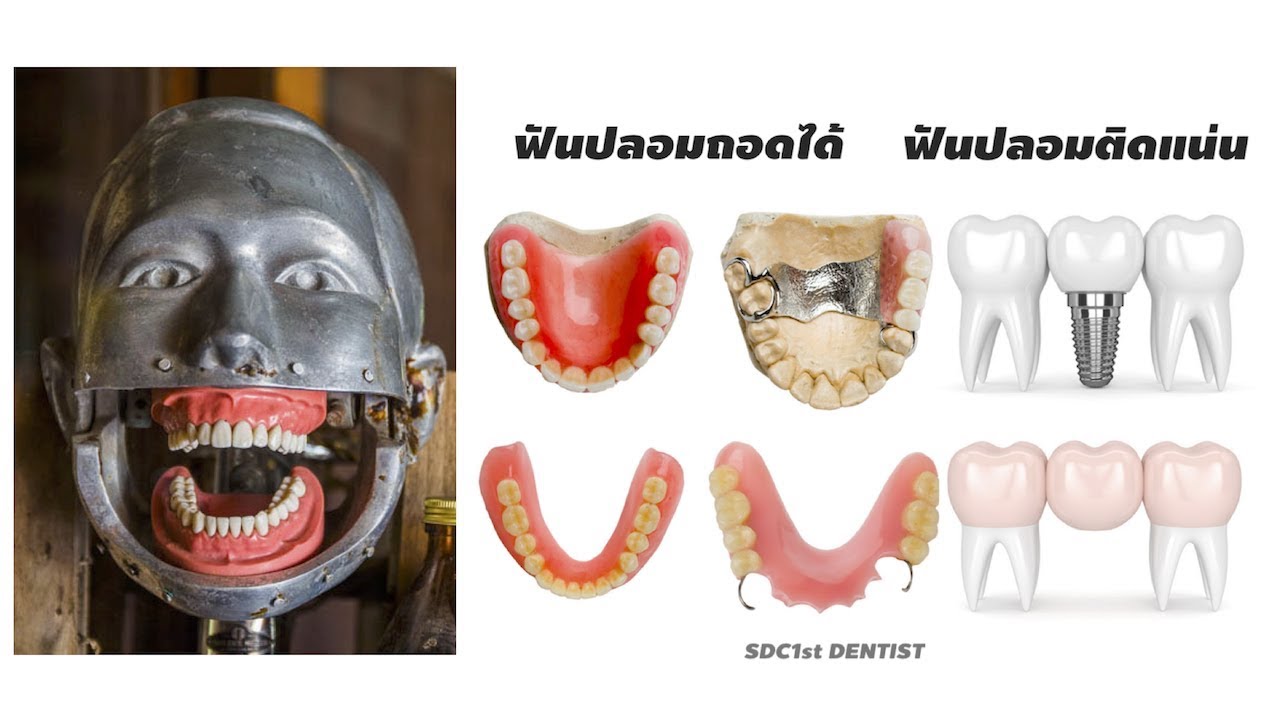ฟันปลอม เรื่องที่คนมักเข้าใจผิดเกี่ยวกับฟันปลอม