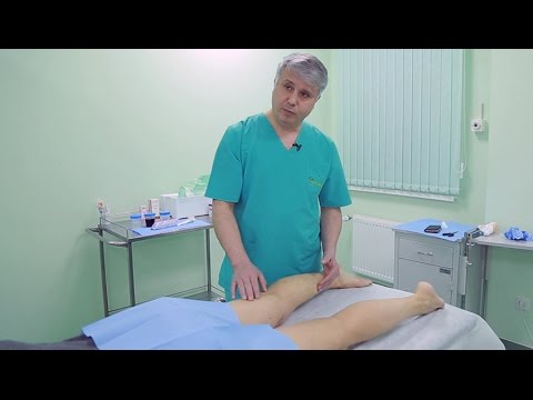 varicoza scapă de pilule contraceptive și varicoză