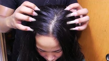Fast & Aggressive ASMR Scratch Itchy Scalp, So I Did! Satisfying Scalp Scratching - No Talking