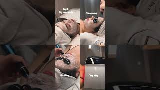 Top.1 Liệu Trình Hot - Cây Trăng Nano White, Ai Thử Cũng Mê