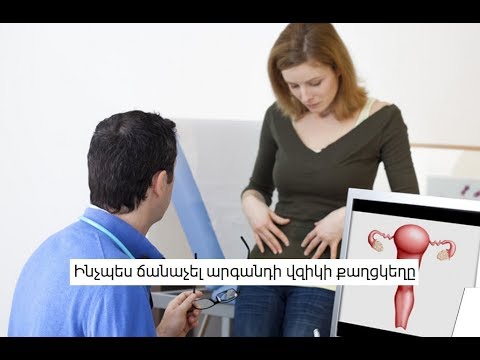 Video: Ինչպես ճանաչել հղիությունը